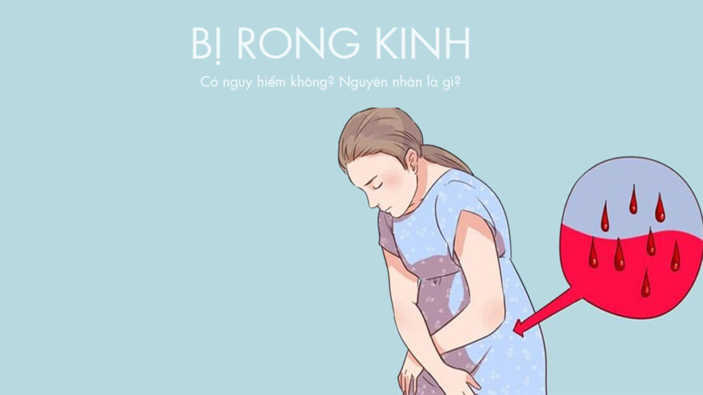 Bị Rong Kinh Có Nguy Hiểm Không? Nguyên Nhân Là Gì?